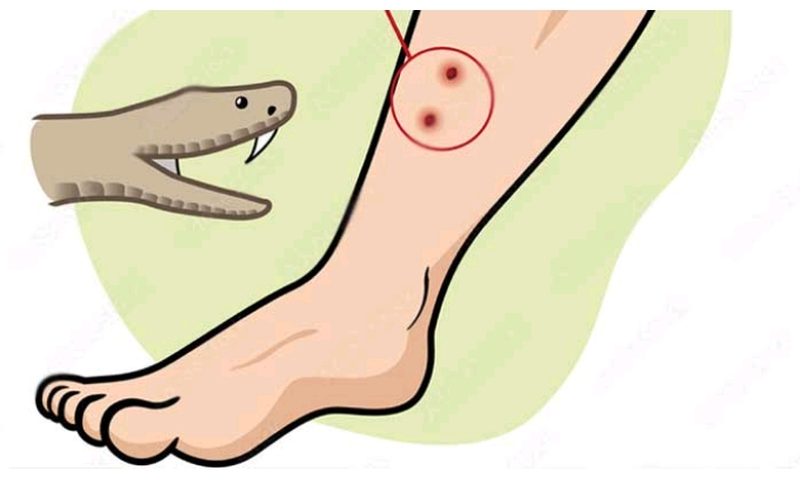 গলাচিপায় সাপের কামড়ে কৃষকের মৃত্যু, আহত দুই গৃহবধূ,